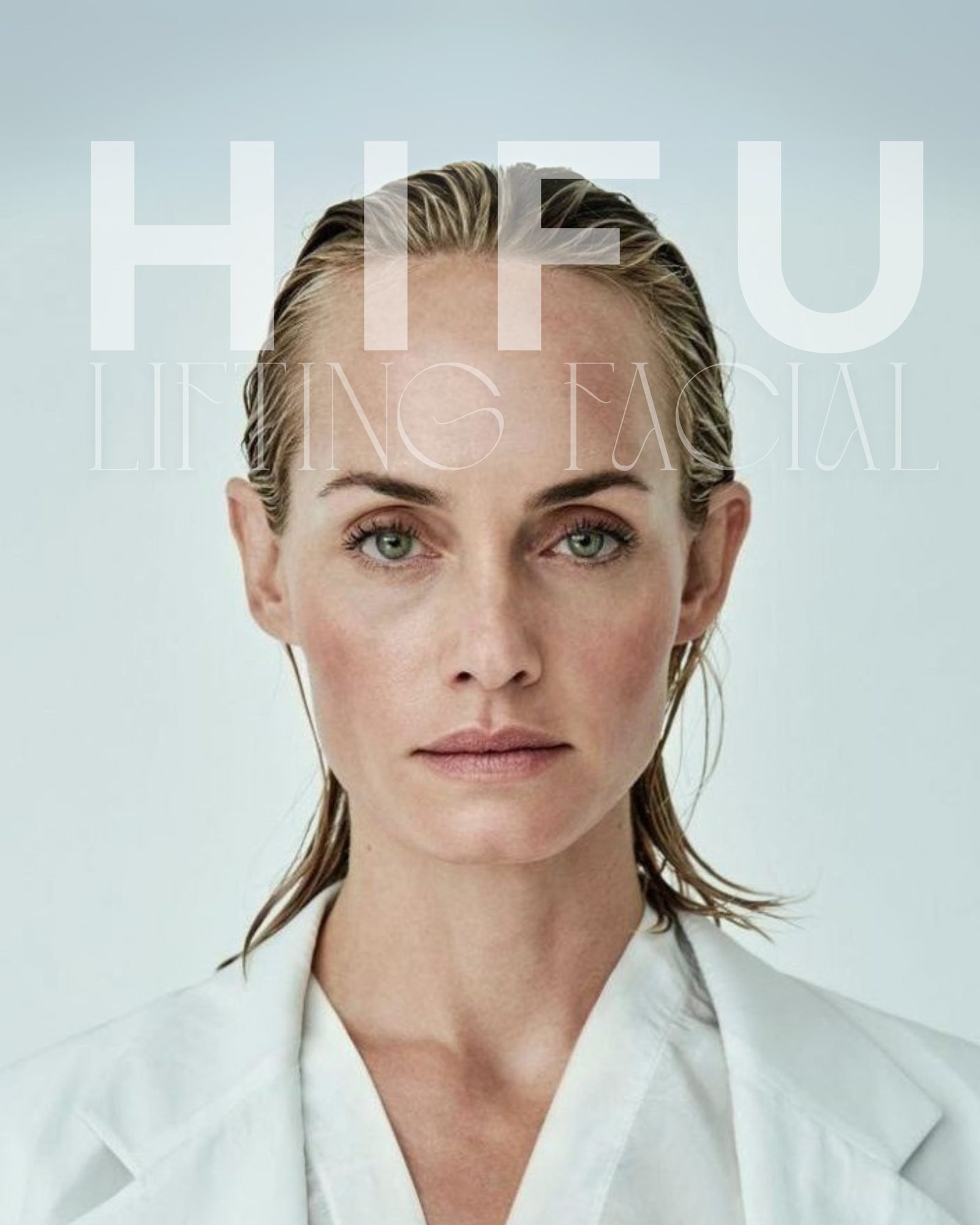 HIFU lifting facial sin cirugía en Las Condes HIFU lifting facial sin cirugía en Las Condes