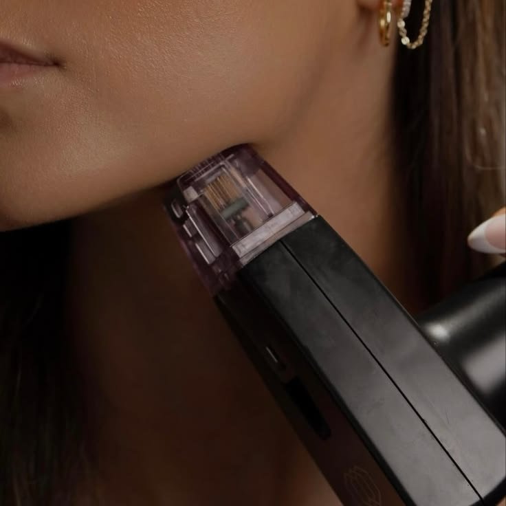 Micron RF, radiofrecuencia con microagujas en Las Condes